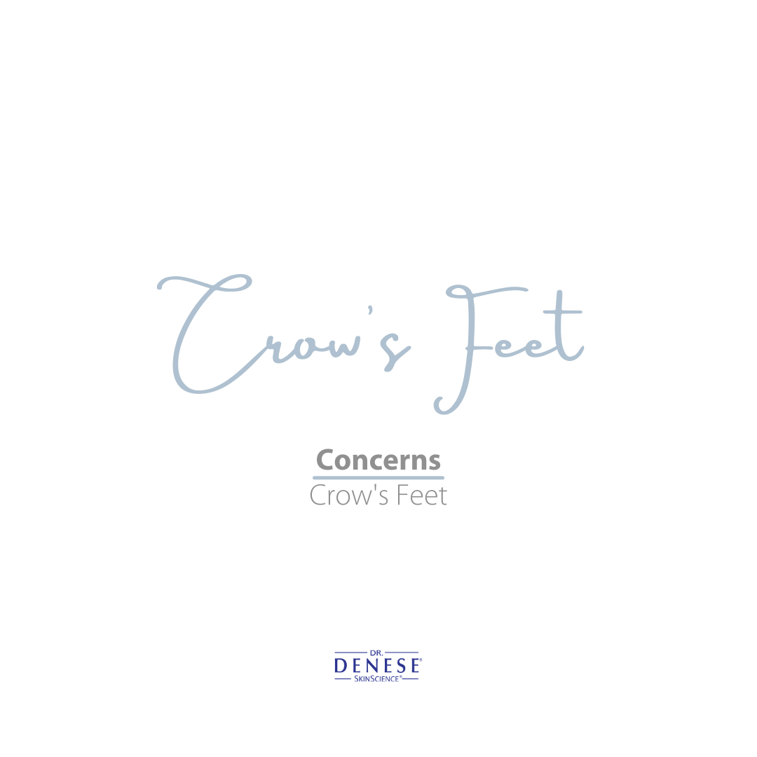 Crow's Feet Treatment