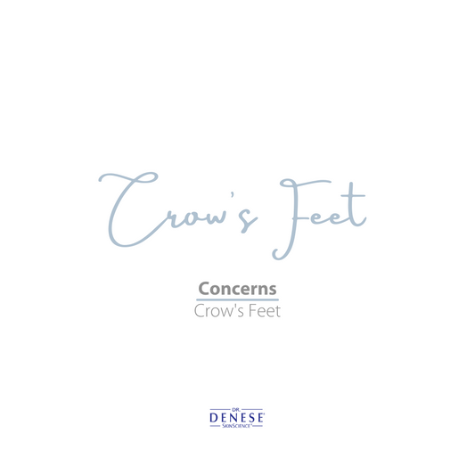 Crow's Feet Treatment