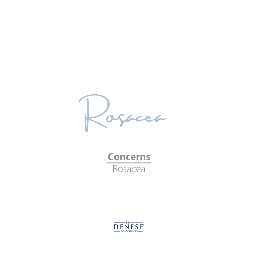 Rosacea Treatments