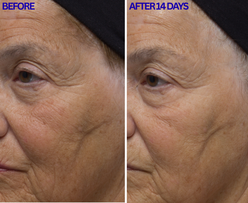 Dr. Denese RetinMax® Retinol Power Duo
