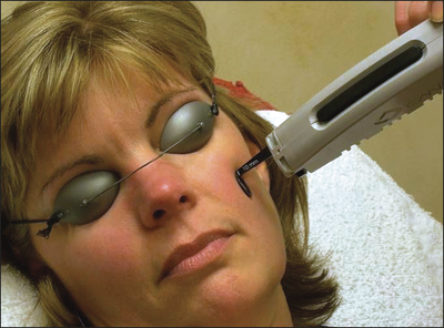 Laser Skin Treatment Series: Anti- Redness Lasers