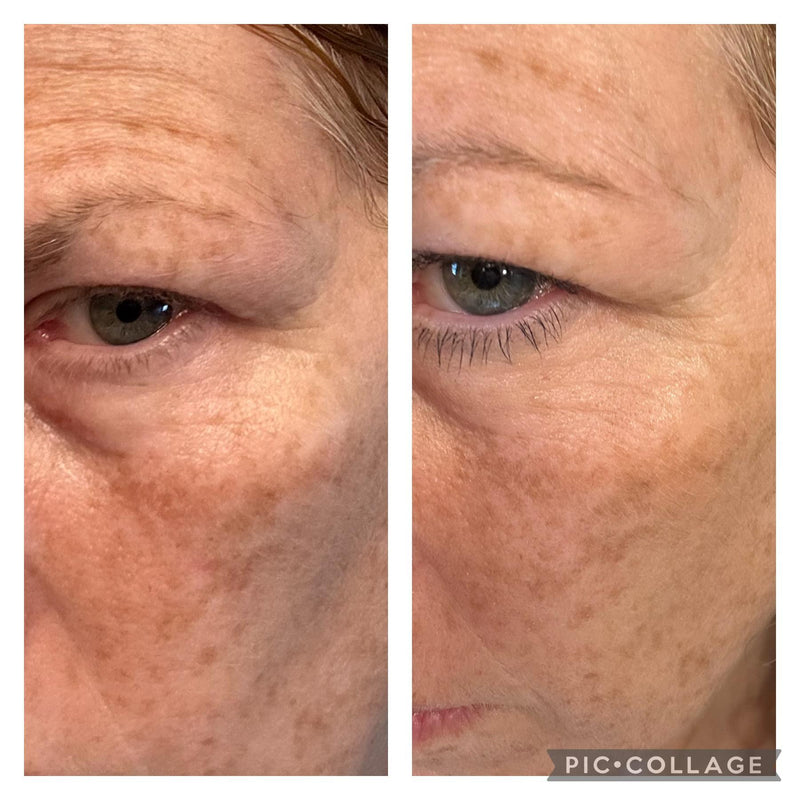 Before and after, sent in by Strwbrrydanish with her review