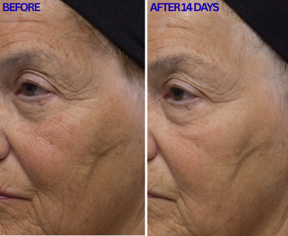 Dr. Denese RetinMax® Retinol Power Duo