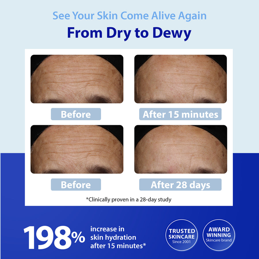Before and after using HydroShield®  Ultra Moisturizing Face Serum