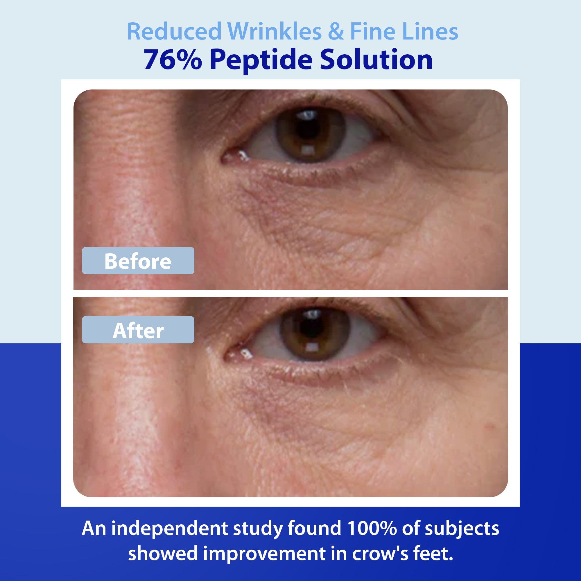 Dr. Denese Wrinkle Rx 76% Peptide Solution Concentrate – DrDenese