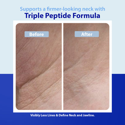 Dr. Denese Triple Strength Neck Wrinkle Smoother