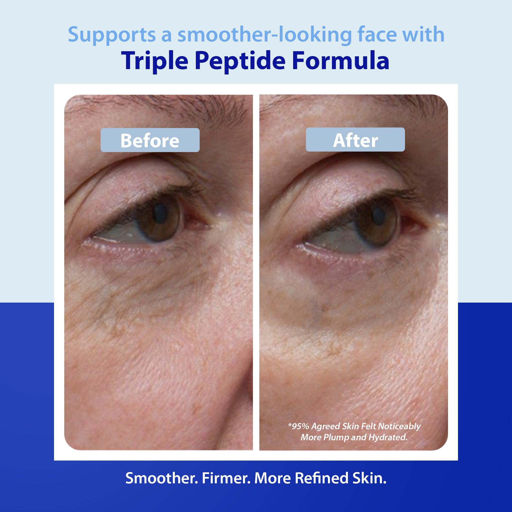 Triple Strength Wrinkle Smoother Advanced Treatment – DrDenese