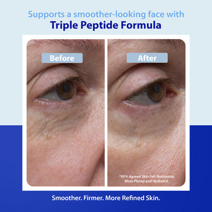 Dr. Denese Triple Strength Wrinkle Smoother Advanced Treatment