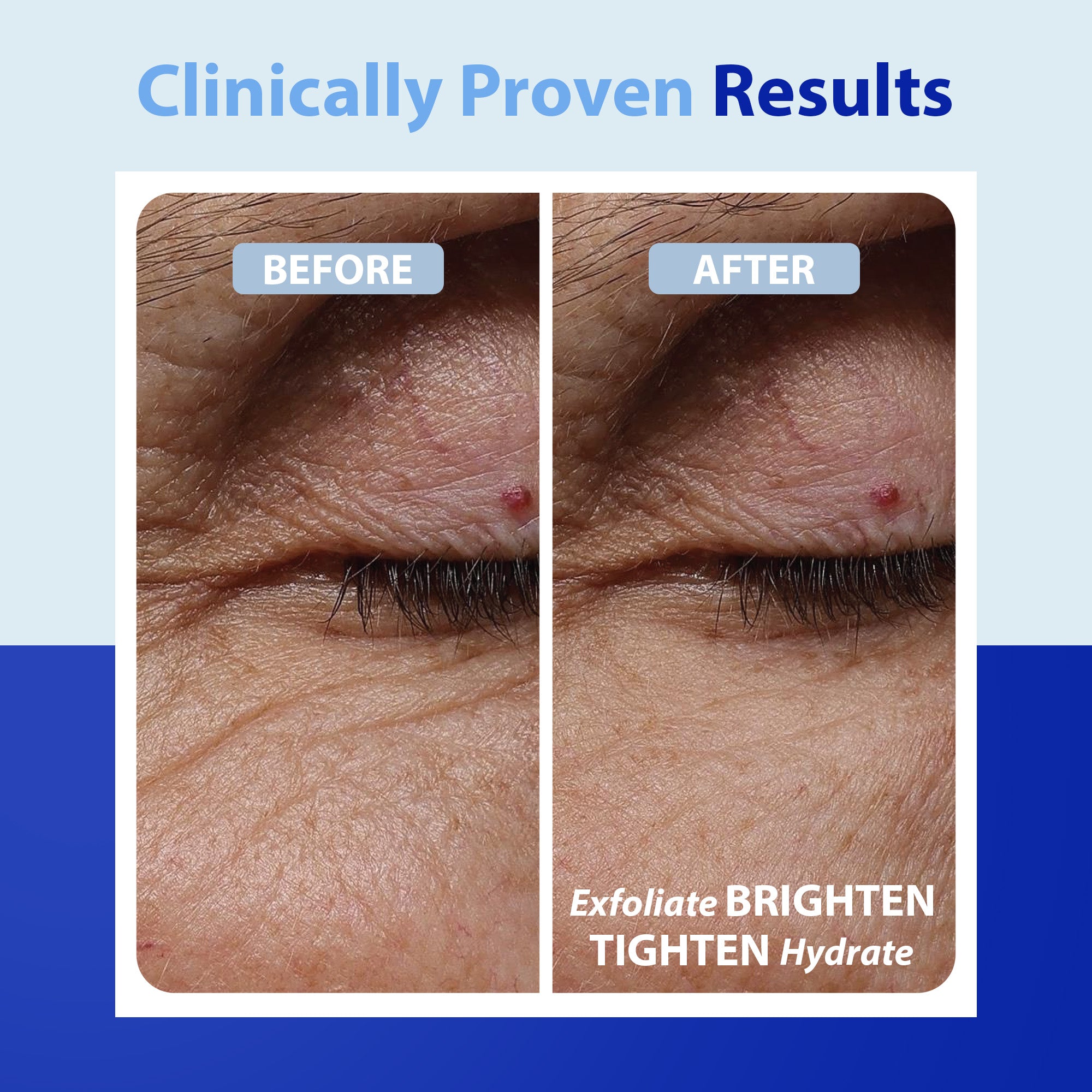 Dr. Denese Advanced Firming Facial Pads – DrDenese