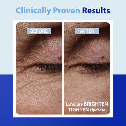 Dr. Denese Advanced Firming Facial Pads