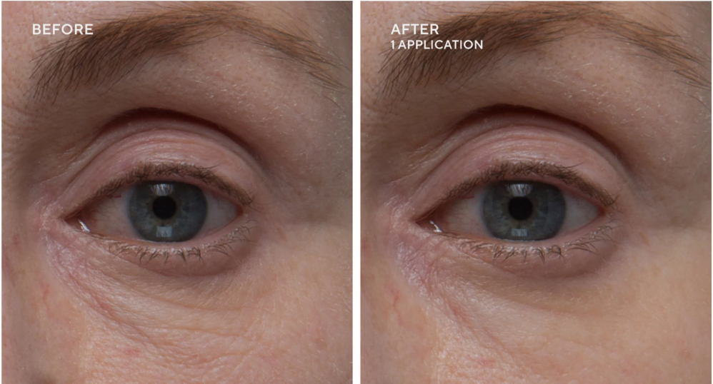 Dr. Denese The HydroBurst Eye Gel Mask