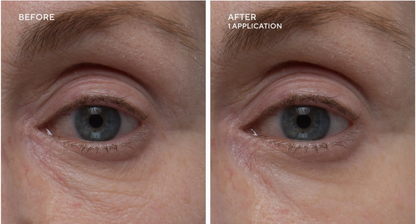 Dr. Denese The HydroBurst Eye Gel Mask
