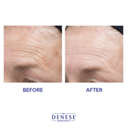 Dr. Denese HydroShield® Ultra Moisturizing Face Serum