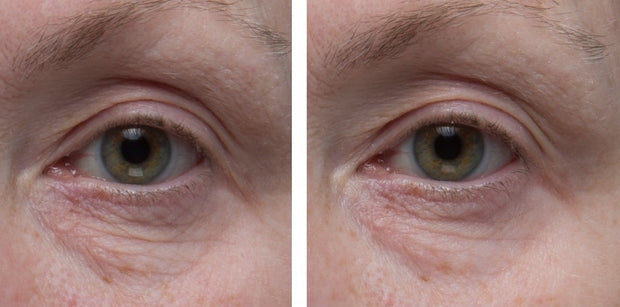 Dr. Denese Firming Facial Collagen Eye Cream