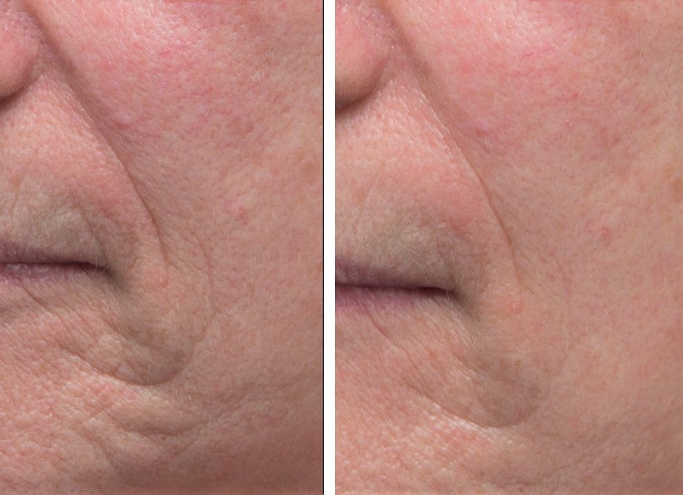 Dr. Denese Firming Facial Collagen Night Serum – DrDenese