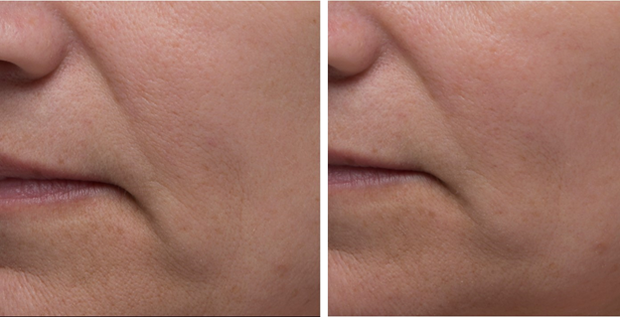 Dr. Denese Firming Facial Collagen Face Cream